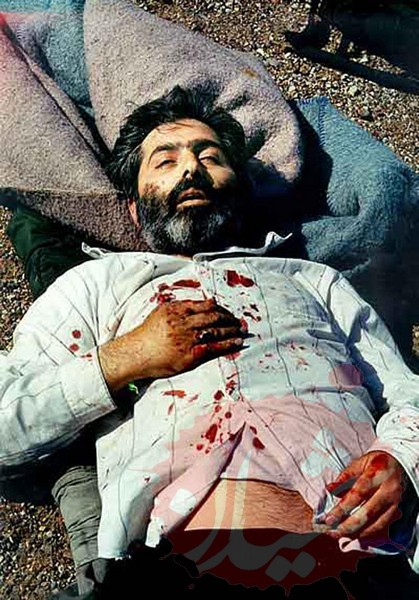 تصاویر مجروح شدن شهید آوینی